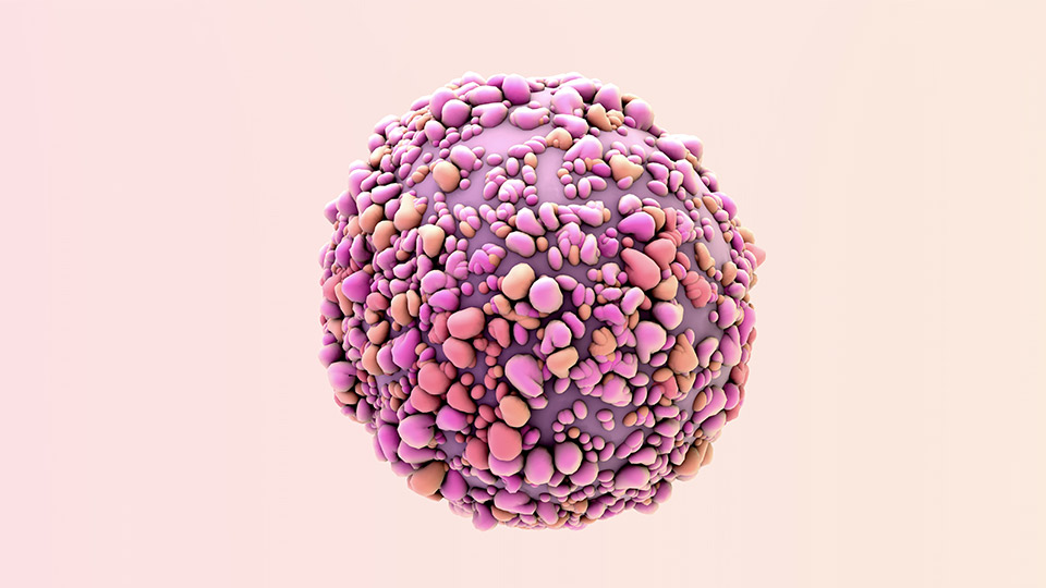 A breast cancer cell.