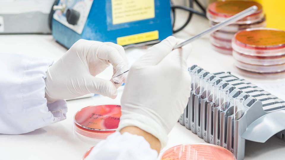 a close up of a petridish in a lab setting